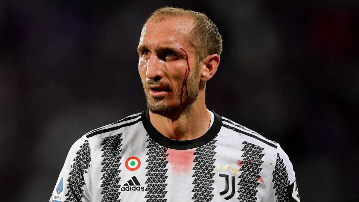 chiellini_fiorentina.png